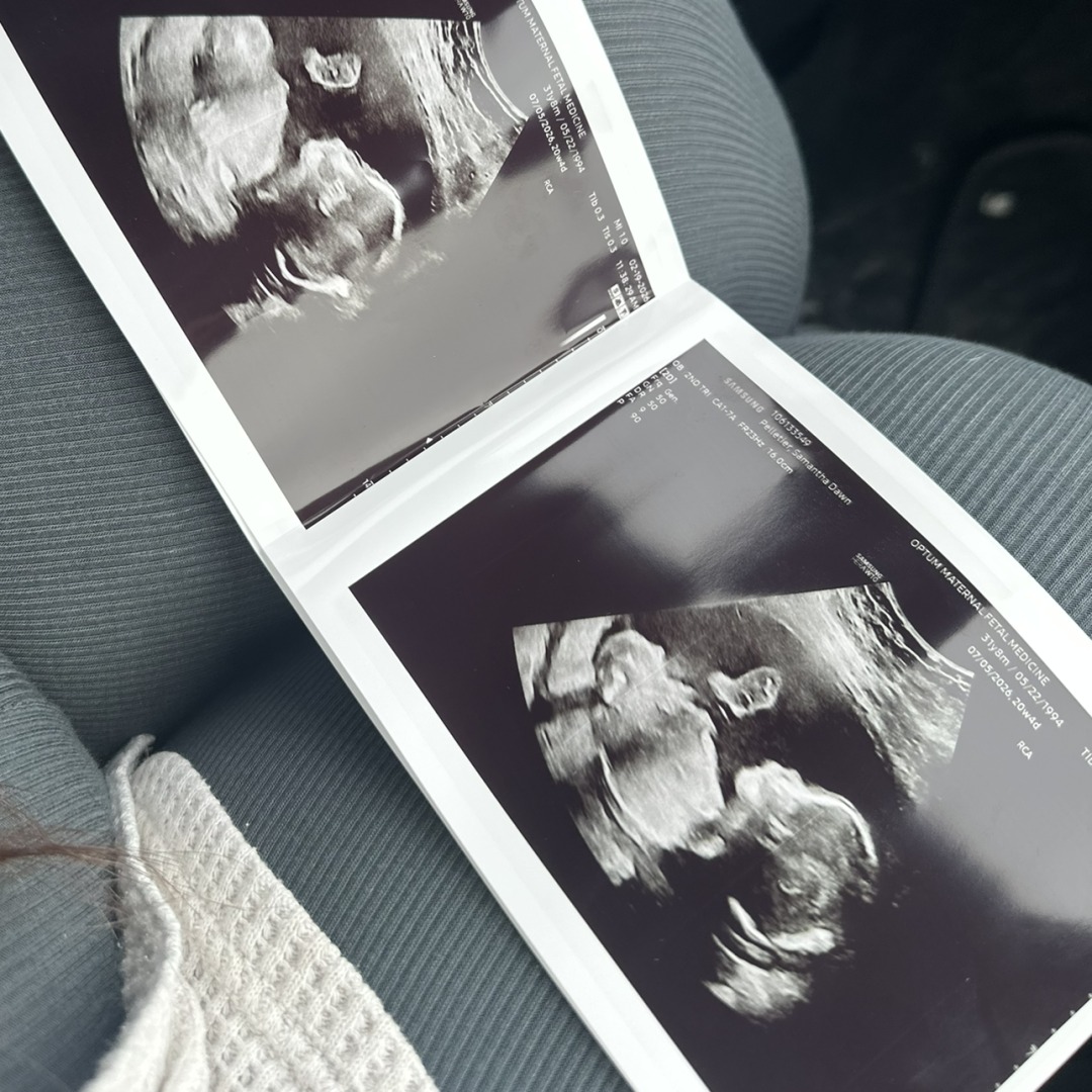 Photo shared by Samantha for their Babylist baby registry.