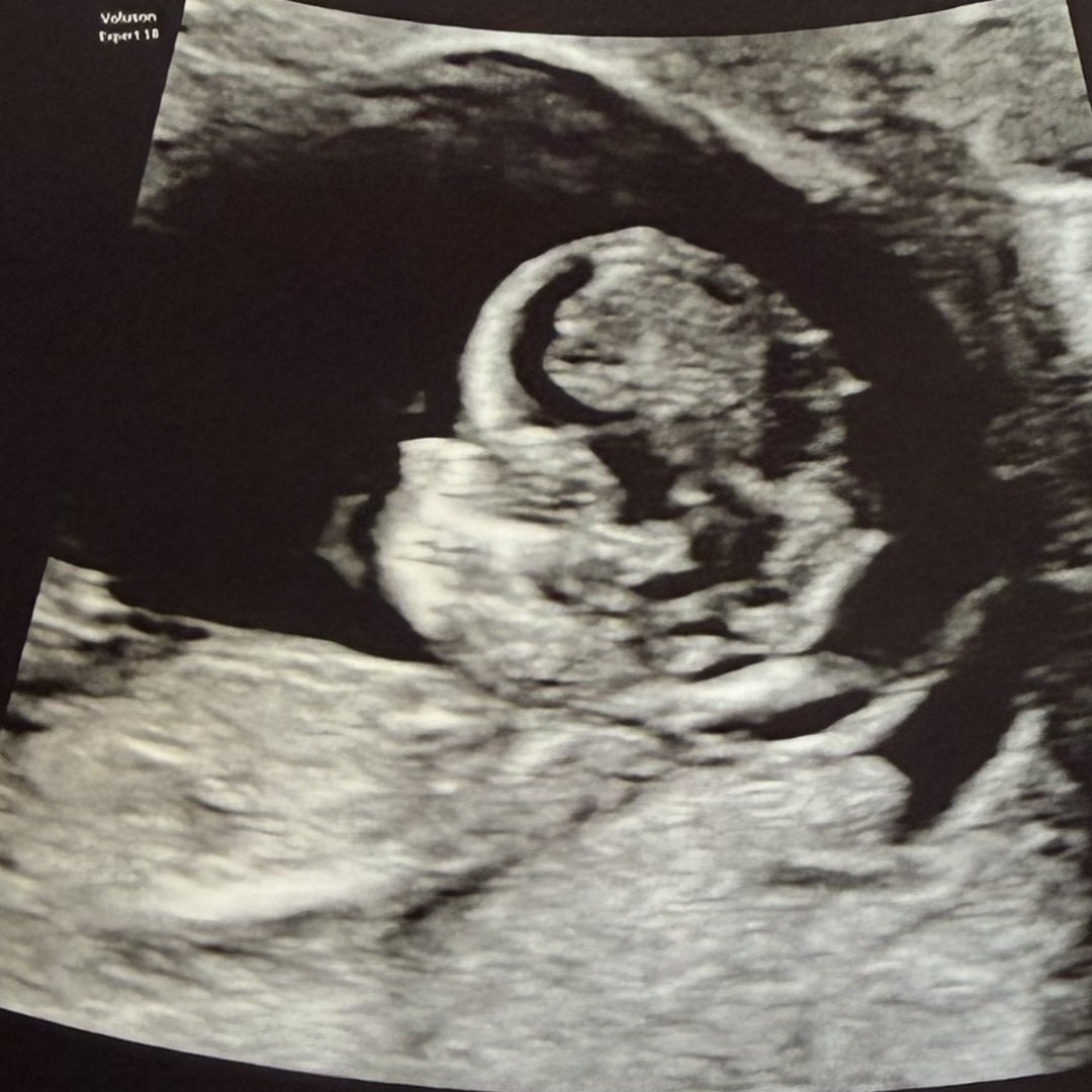 Photo shared by Rena for their Babylist baby registry.