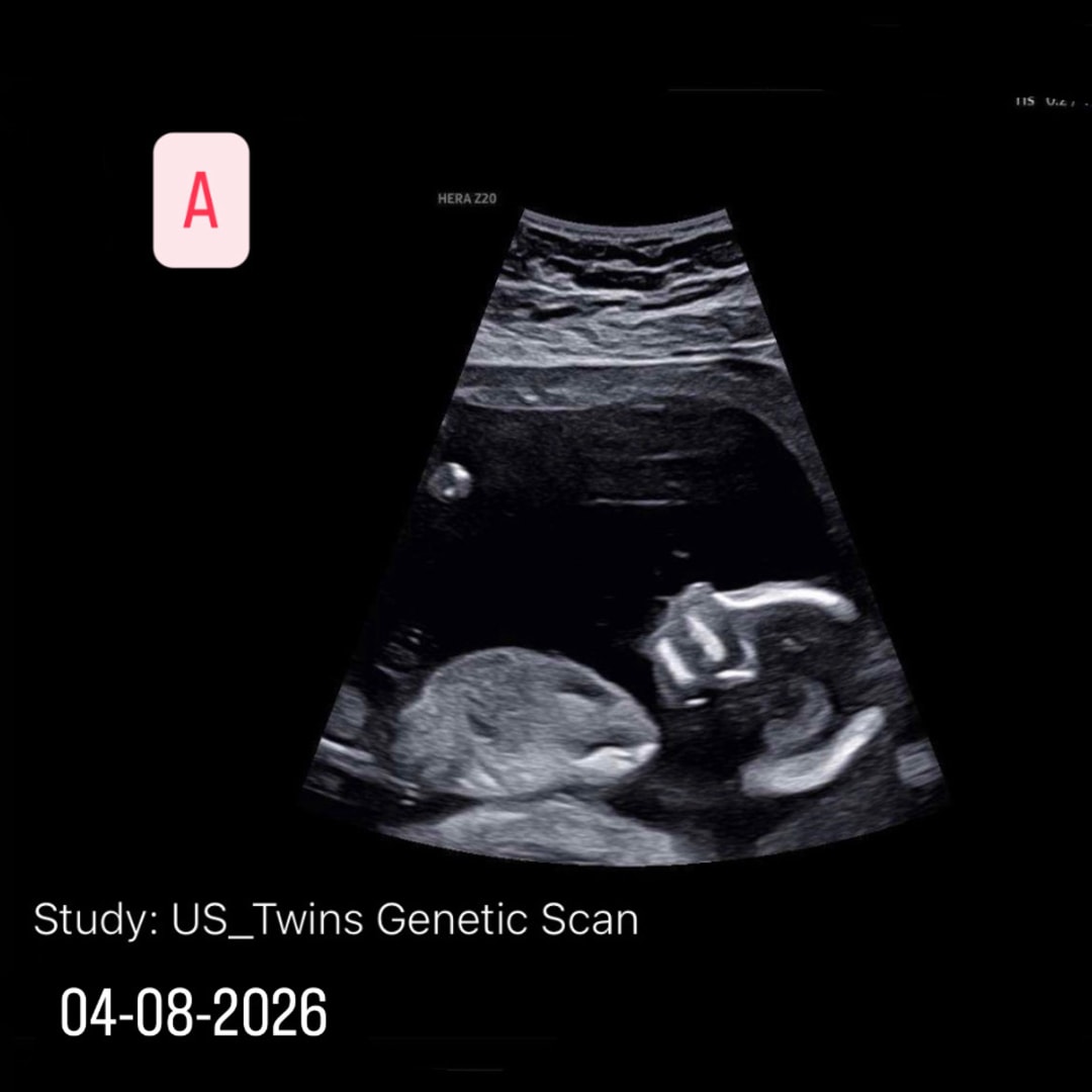Photo shared by Patricia for their Babylist baby registry.