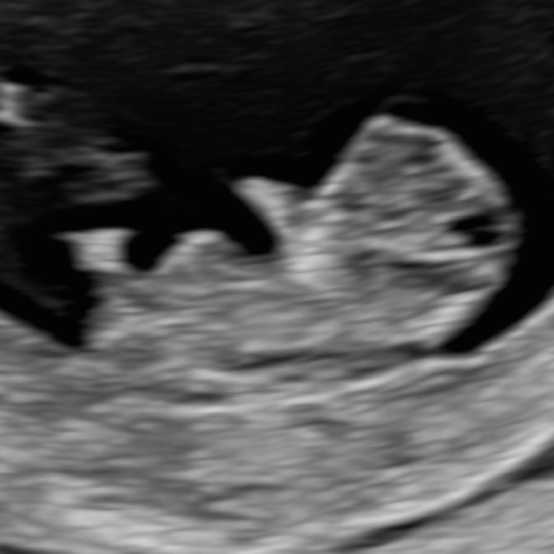 Photo shared by Mckayla for their Babylist baby registry.