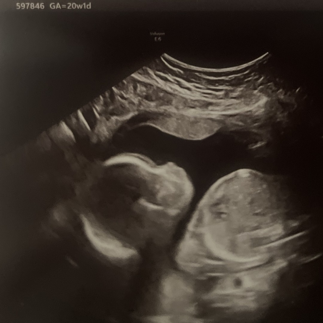 Photo shared by Breonna for their Babylist baby registry.