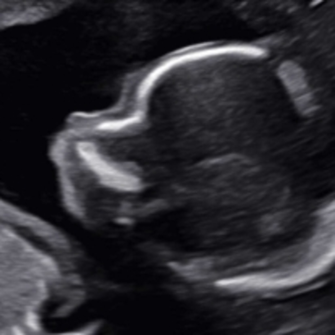 Photo shared by Maria for their Babylist baby registry.