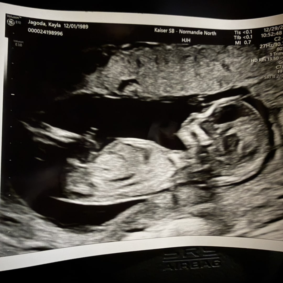 Photo shared by Kayla for their Babylist baby registry.