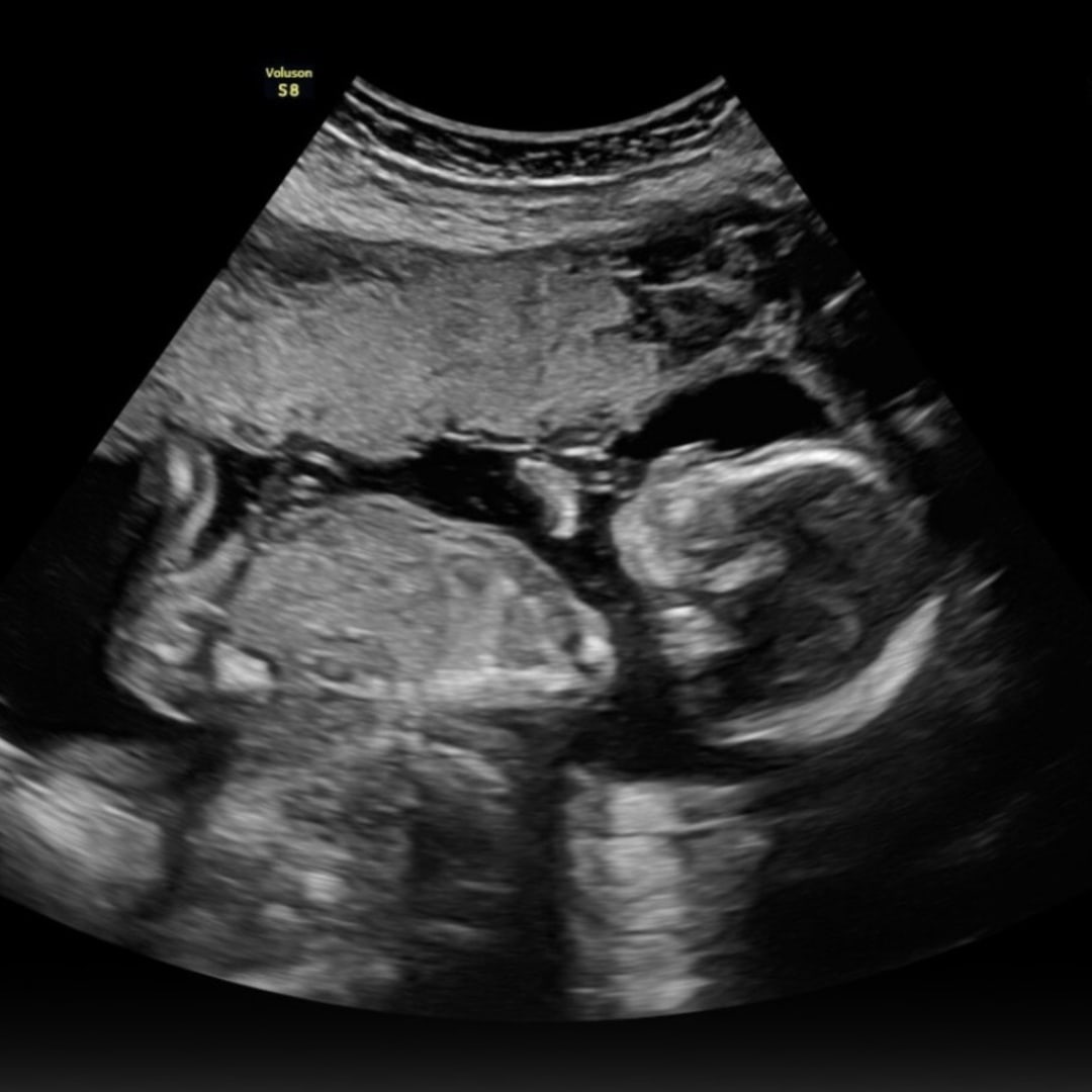 Photo shared by Emilee for their Babylist baby registry.
