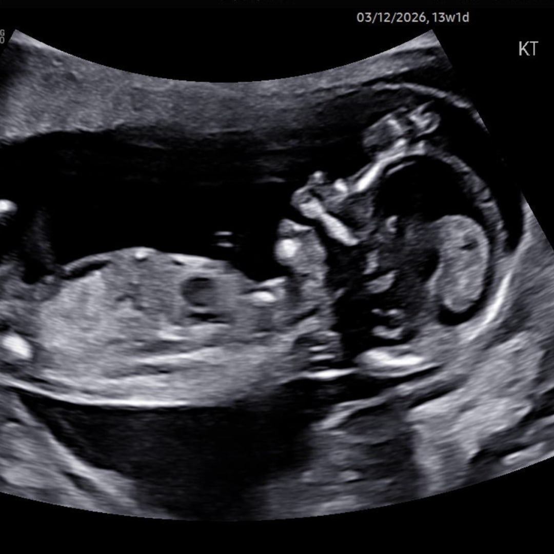 Photo shared by Kathryn for their Babylist baby registry.