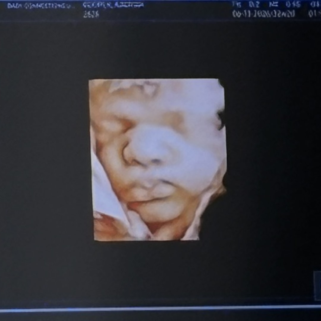 Photo shared by Aaliyah for their Babylist baby registry.