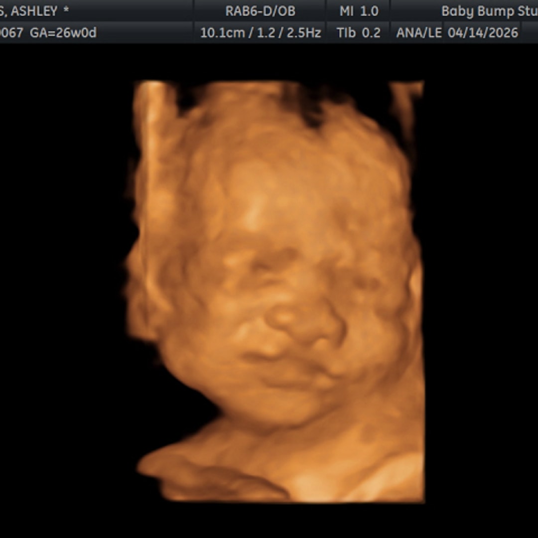 Photo shared by Ashley for their Babylist baby registry.