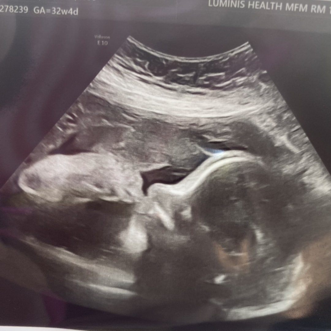 Photo shared by Becka for their Babylist baby registry.