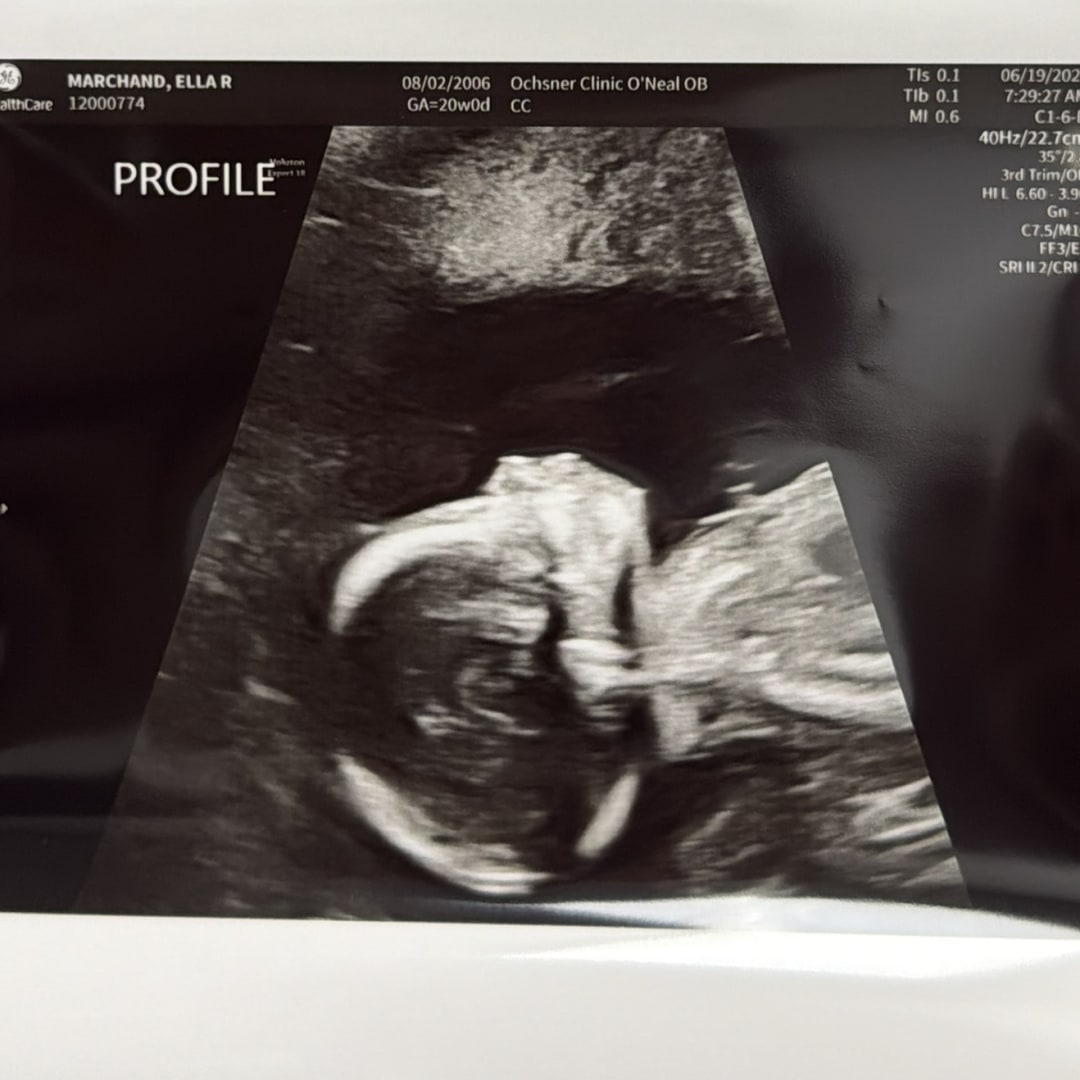 Photo shared by Ella for their Babylist baby registry.