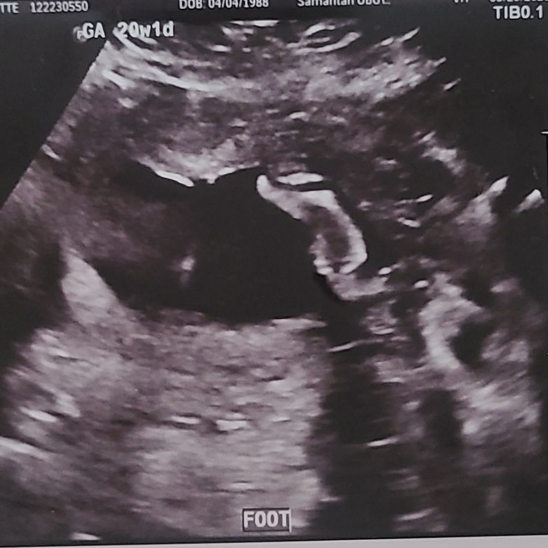 Photo shared by Nicolette for their Babylist baby registry.