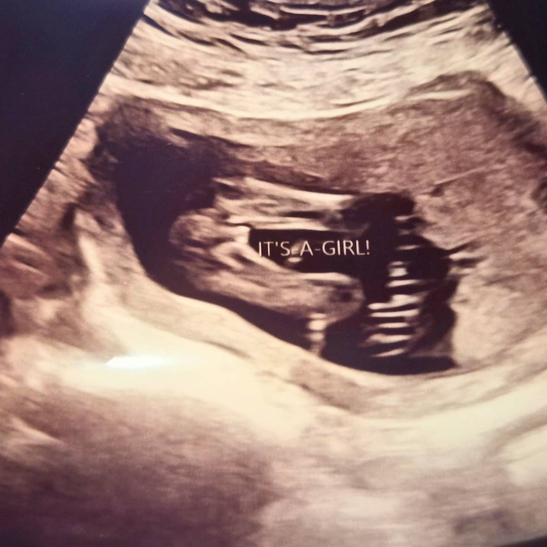 Photo shared by Carrieanne for their Babylist baby registry.
