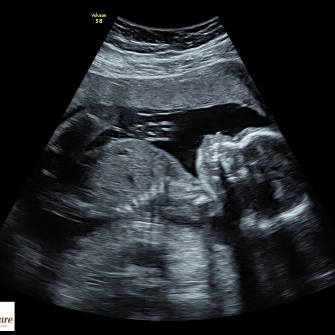 Photo shared by Ariel for their Babylist baby registry.