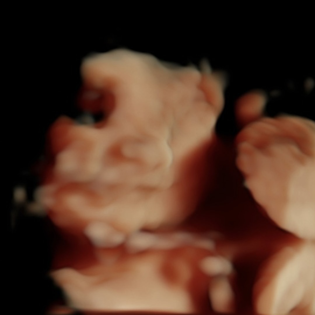 Photo shared by Emily for their Babylist baby registry.