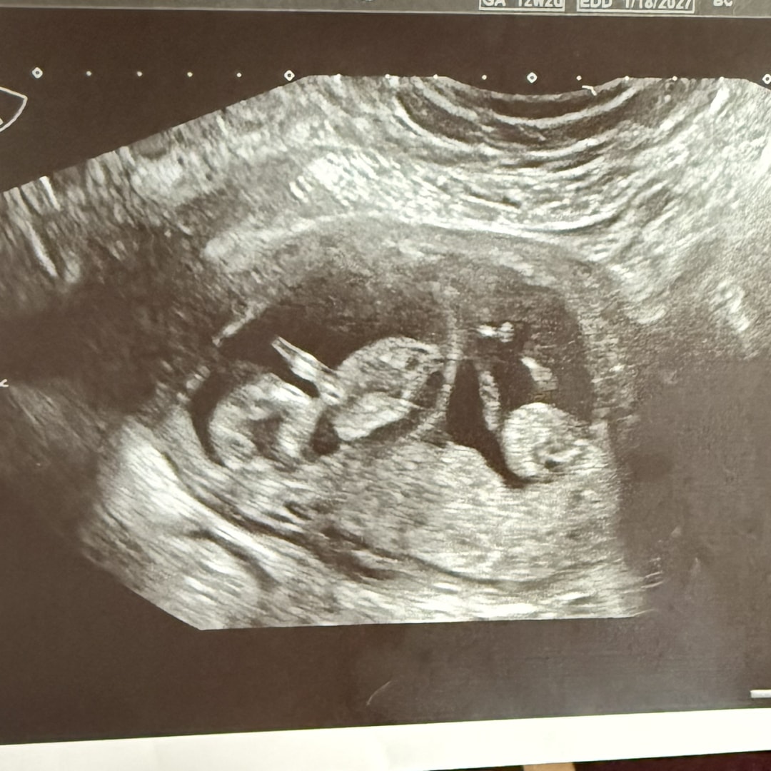 Photo shared by Priscilla for their Babylist baby registry.