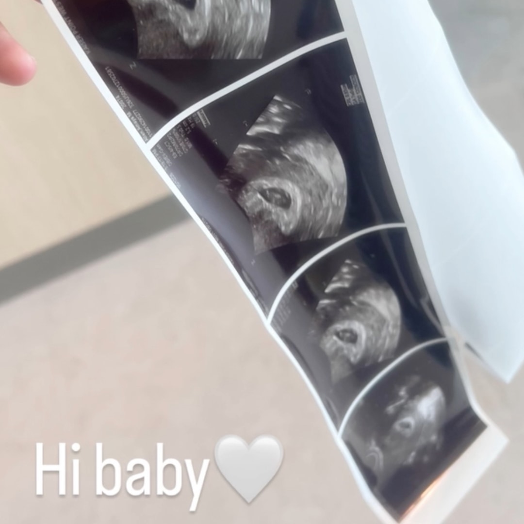 Photo shared by Amaya for their Babylist baby registry.