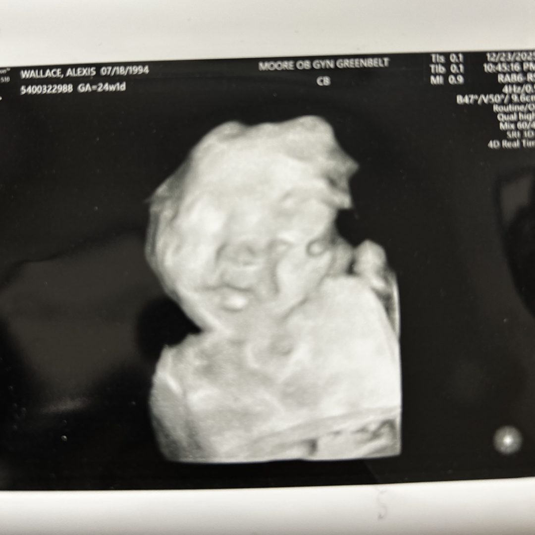 Photo shared by Alexis for their Babylist baby registry.