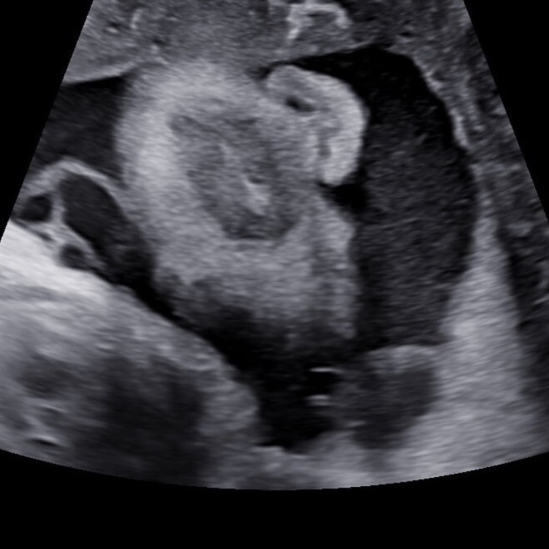 Photo shared by Dekenya for their Babylist baby registry.