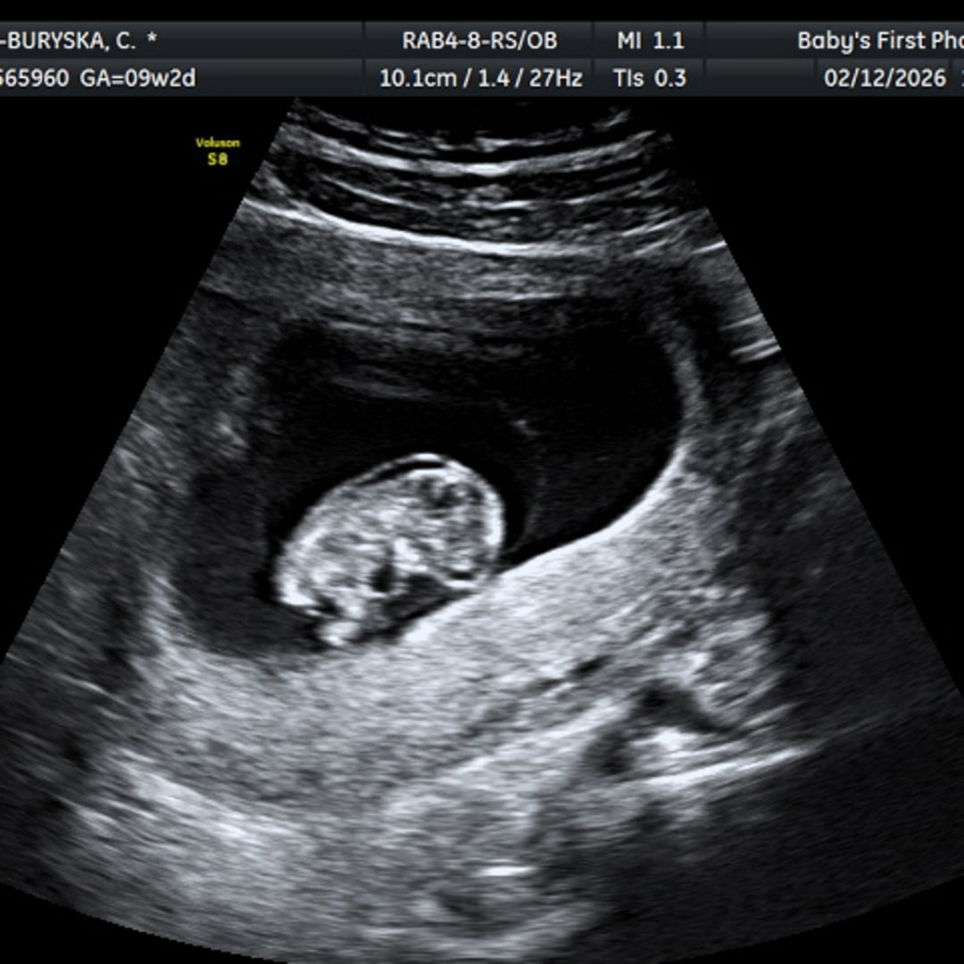 Photo shared by Brenden for their Babylist baby registry.