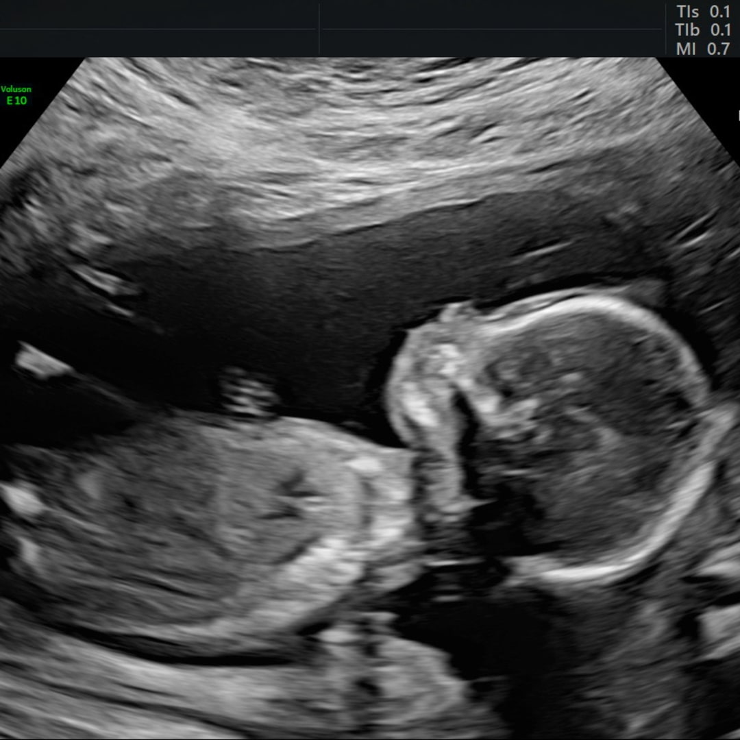 Photo shared by Sam for their Babylist baby registry.