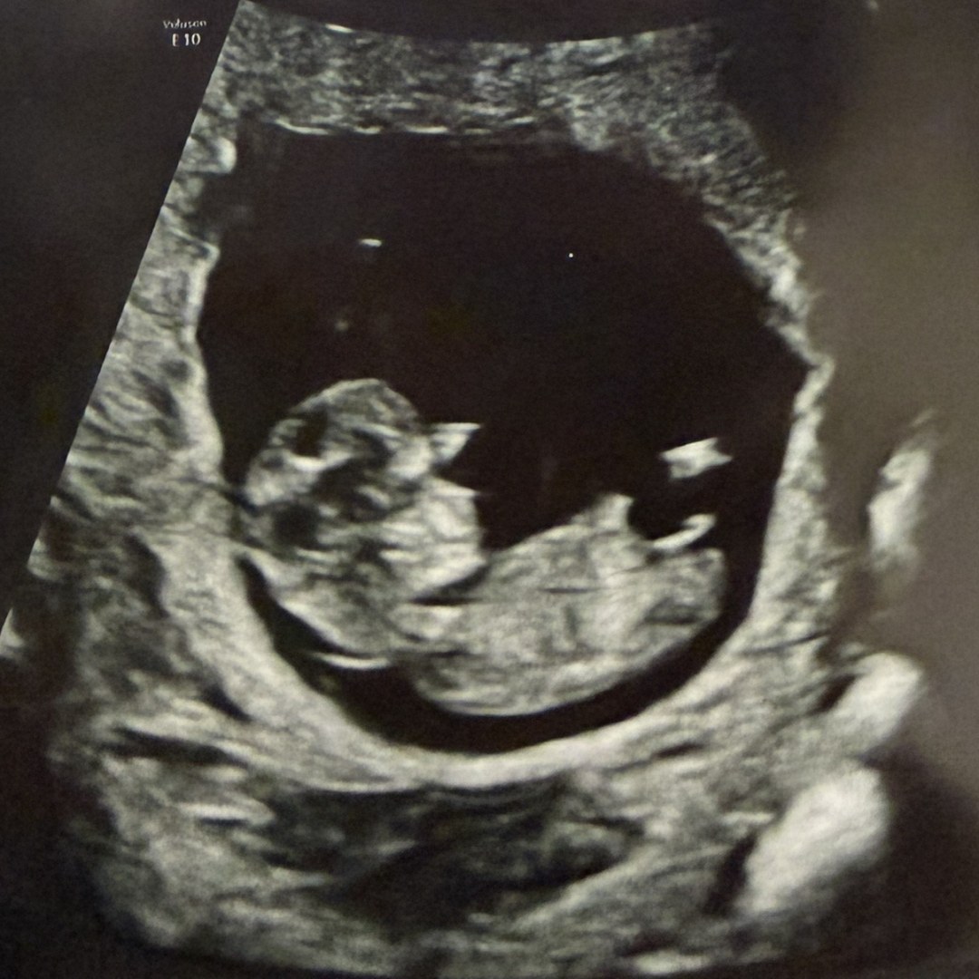 Photo shared by Taylor for their Babylist baby registry.