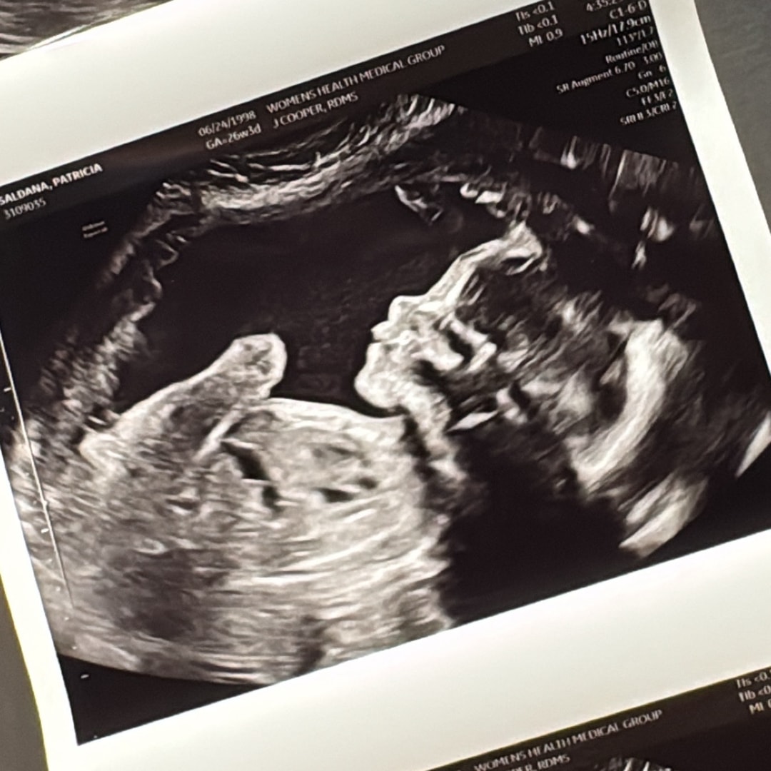Photo shared by Patricia for their Babylist baby registry.