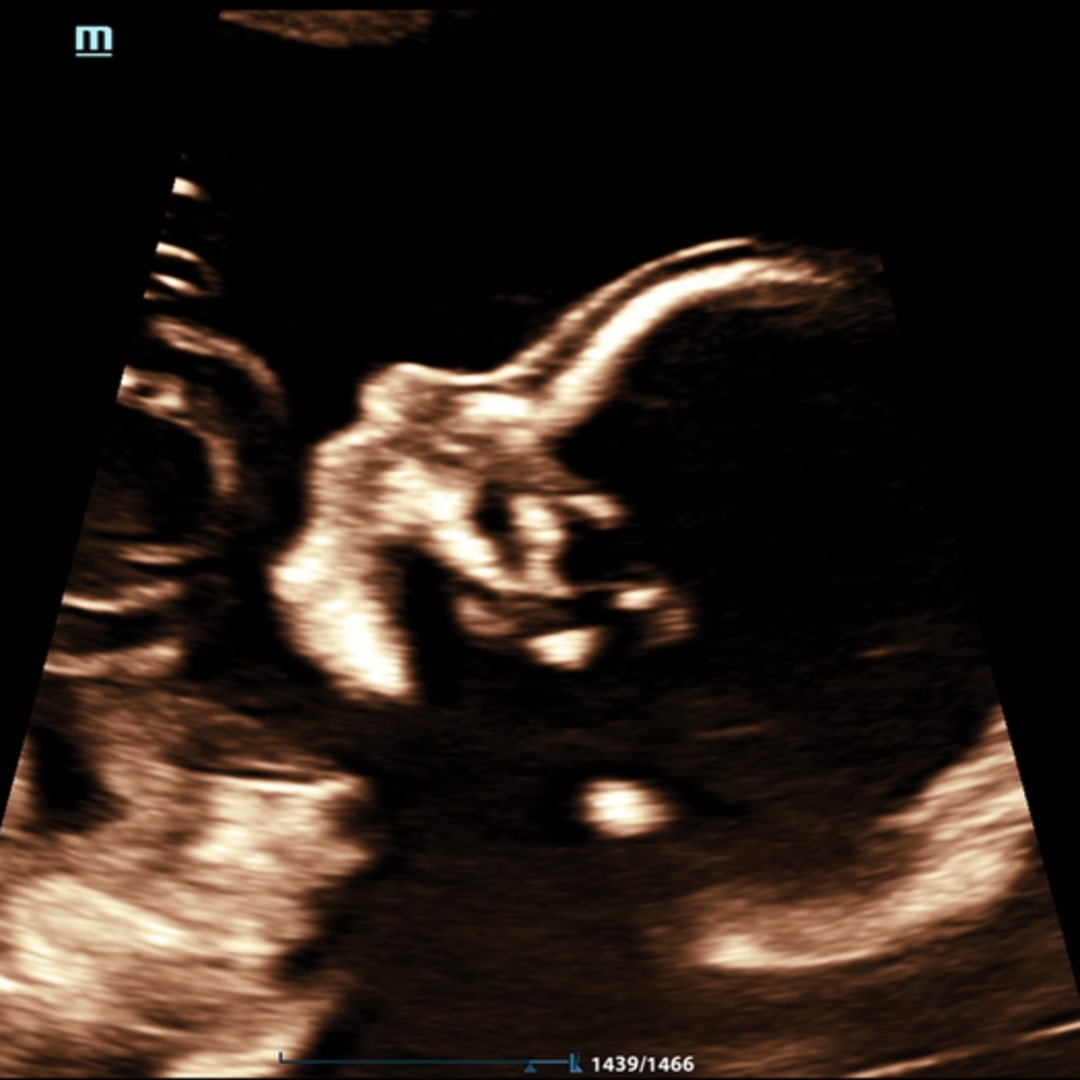 Photo shared by Jacqueline for their Babylist baby registry.