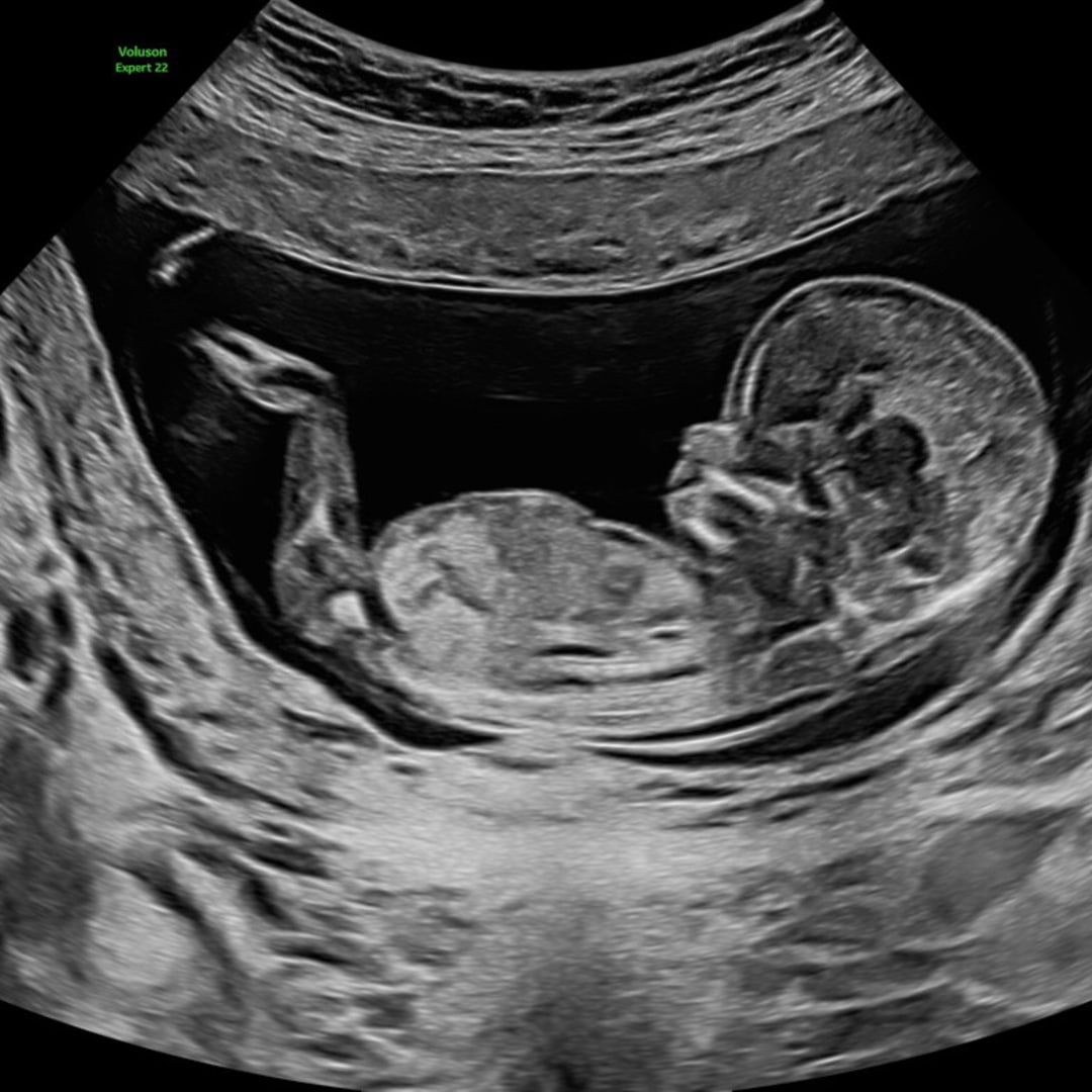 Photo shared by Breanna for their Babylist baby registry.