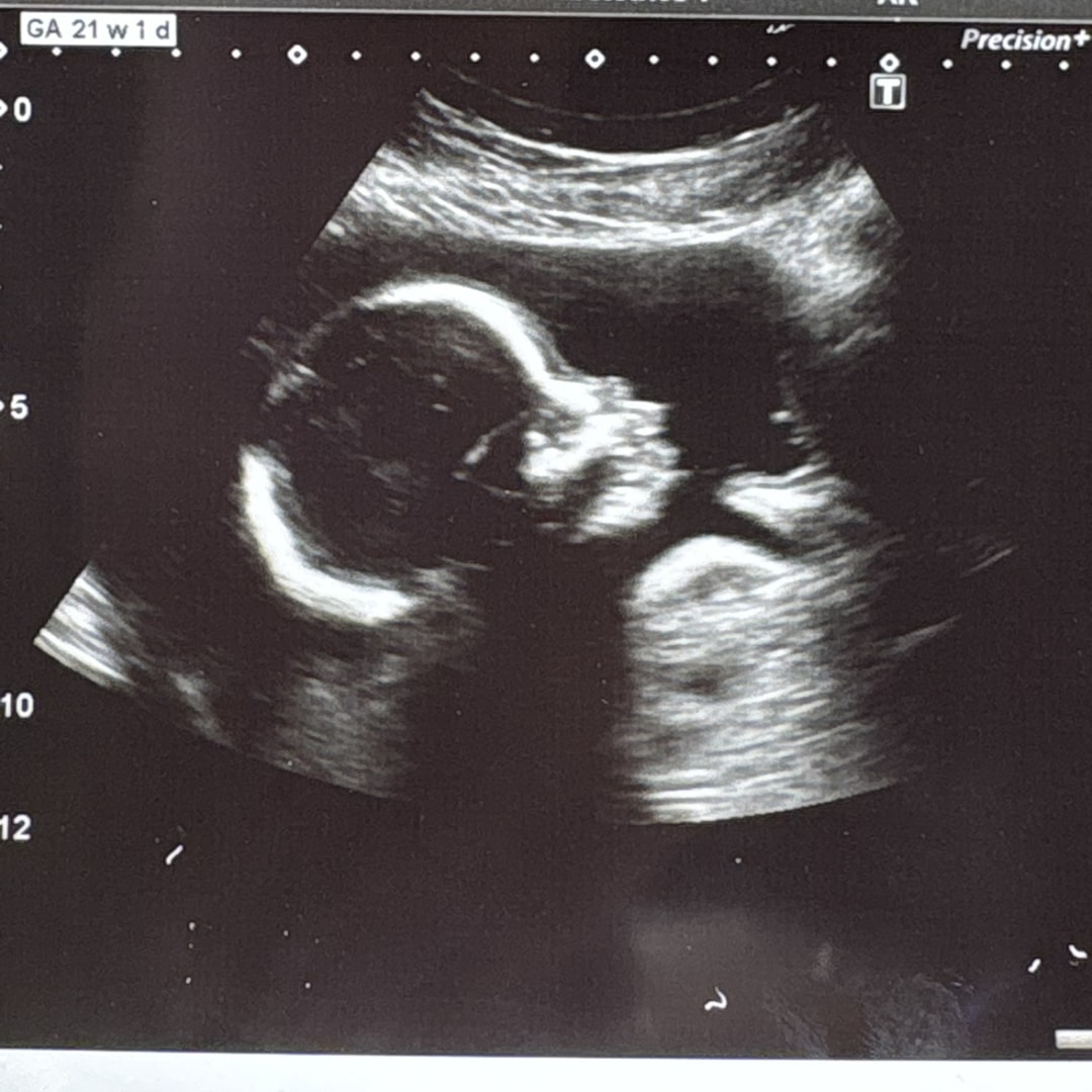 Photo shared by Ashley for their Babylist baby registry.