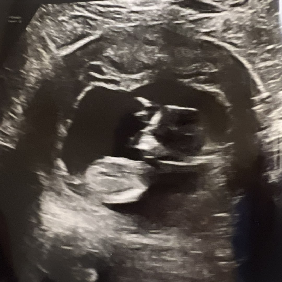 Photo shared by Sidney & Brandon for their Babylist baby registry.