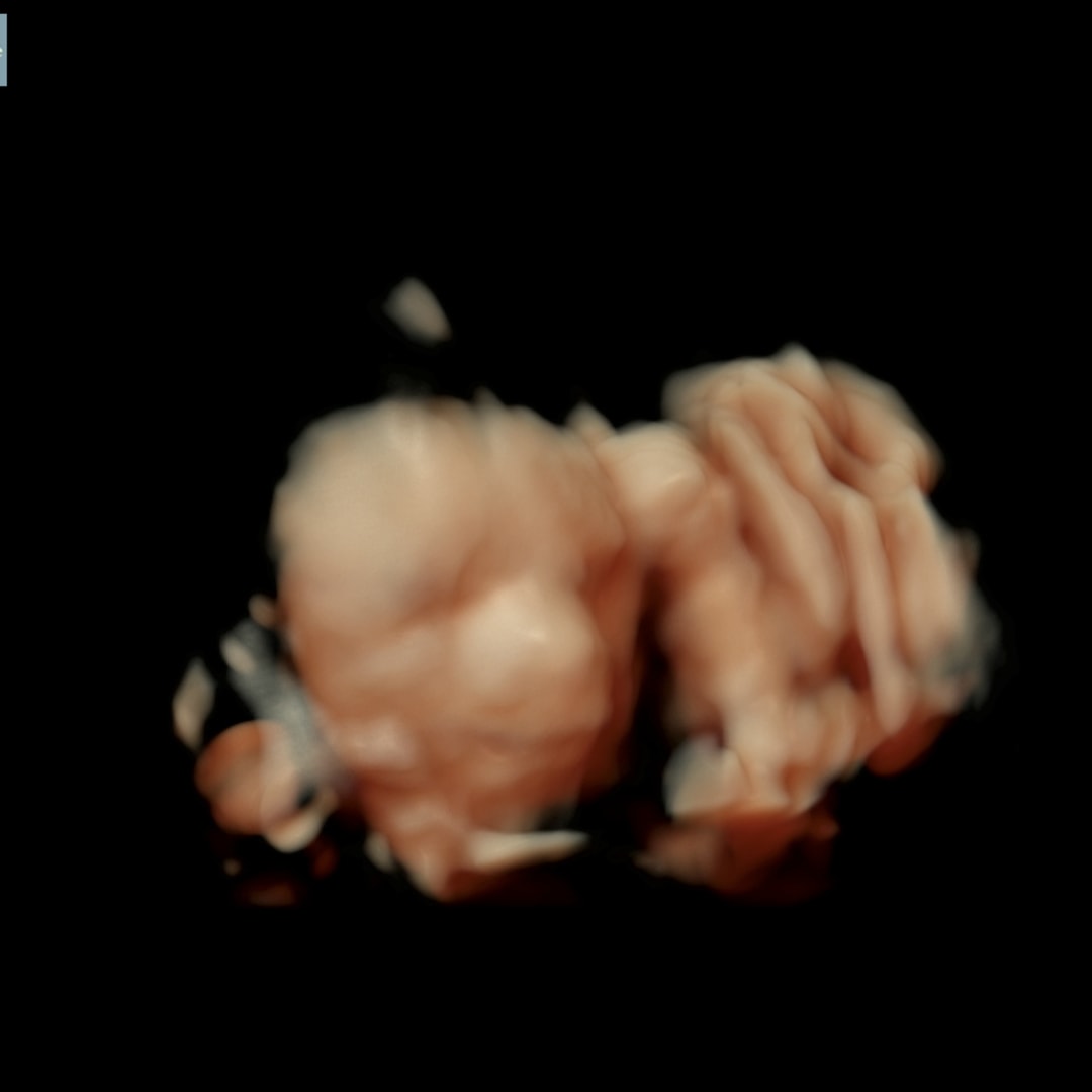 Photo shared by Emma for their Babylist baby registry.