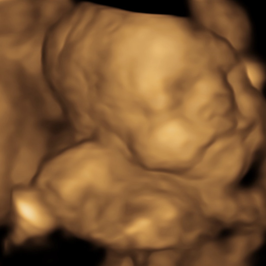 Photo shared by Maegan for their Babylist baby registry.