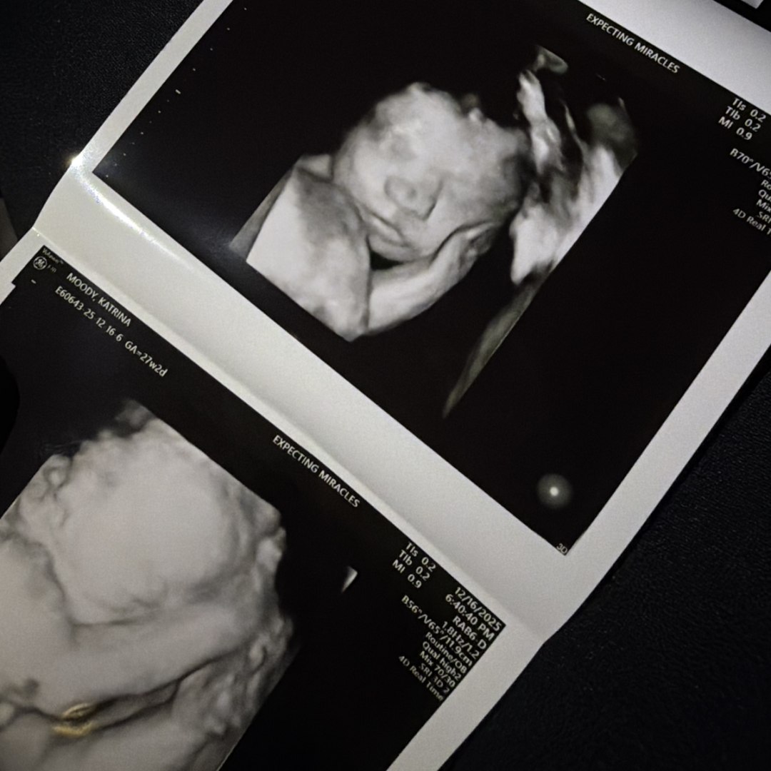 Photo shared by Katrina for their Babylist baby registry.