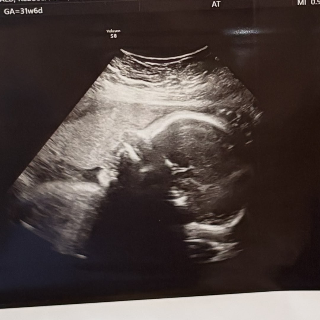 Photo shared by Rebecca for their Babylist baby registry.