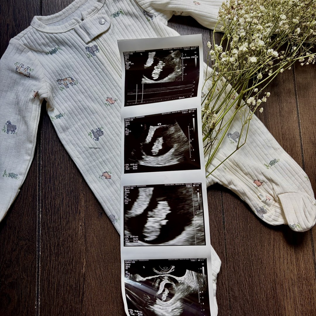 Photo shared by Jessica for their Babylist baby registry.