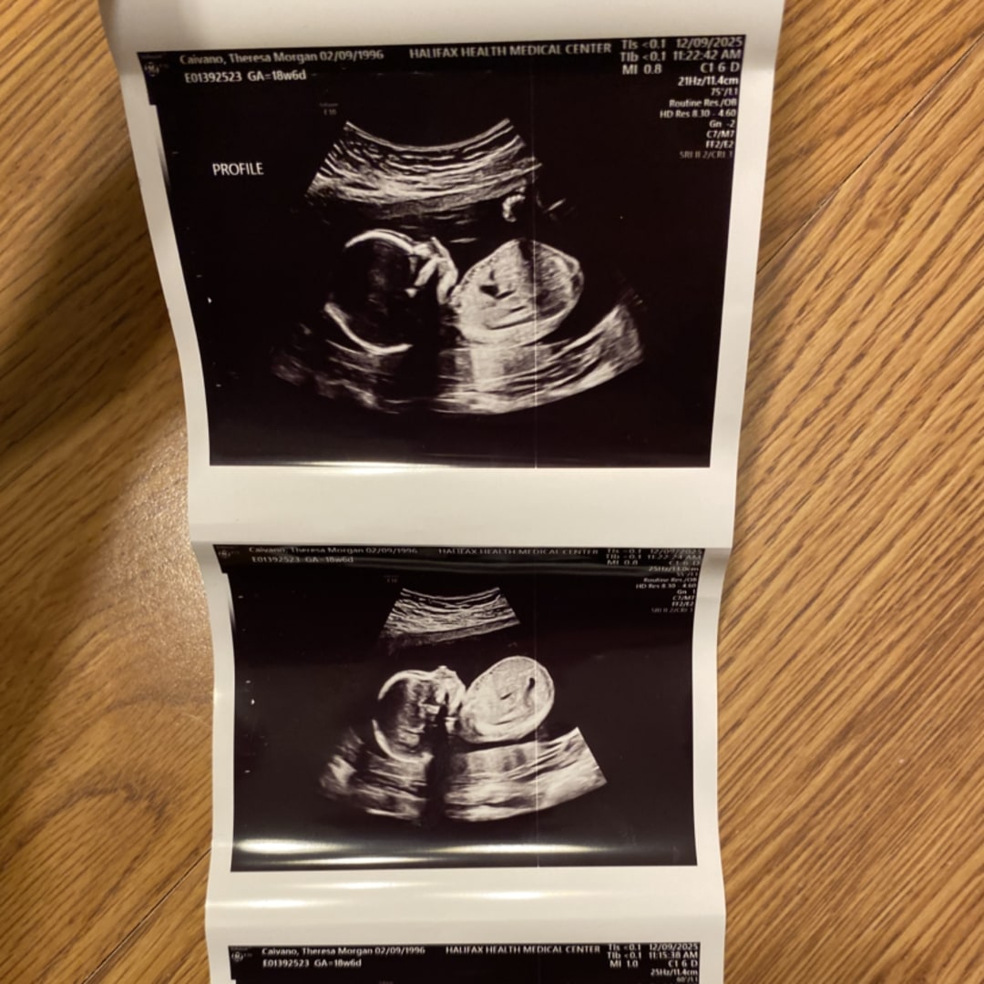 Photo shared by Morgan for their Babylist baby registry.