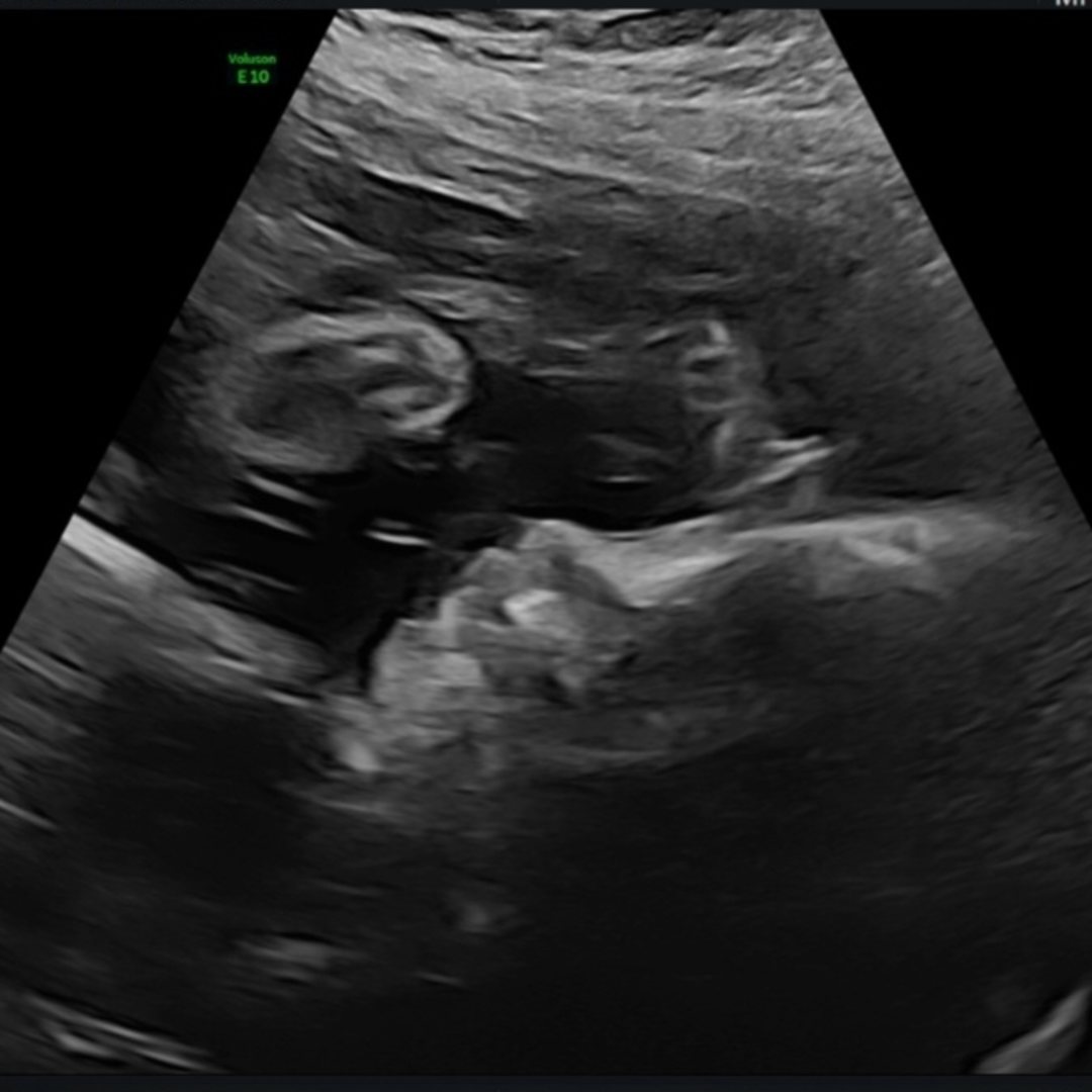 Photo shared by Candice for their Babylist baby registry.