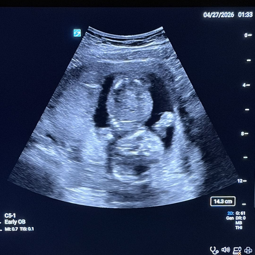 Photo shared by Erin for their Babylist baby registry.