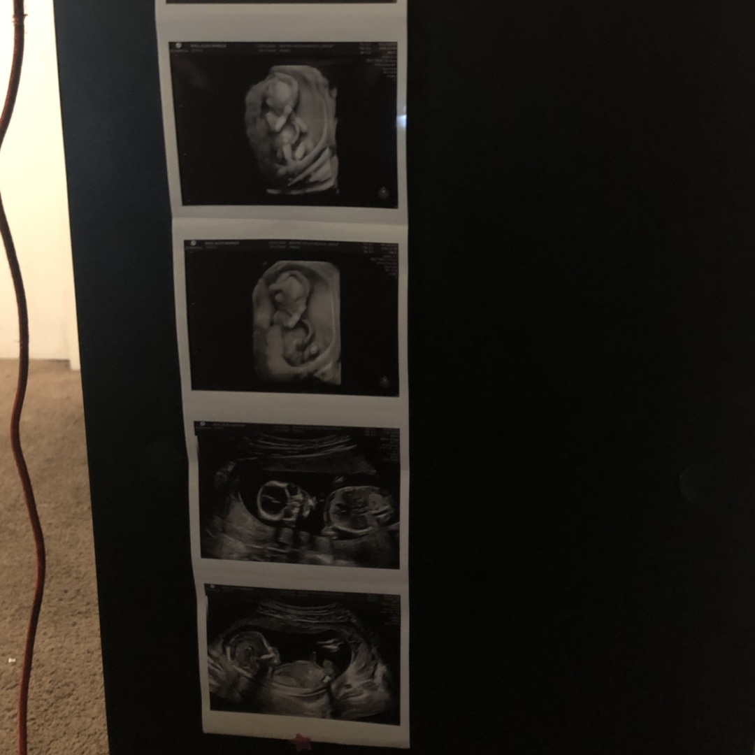 Photo shared by Alice for their Babylist baby registry.