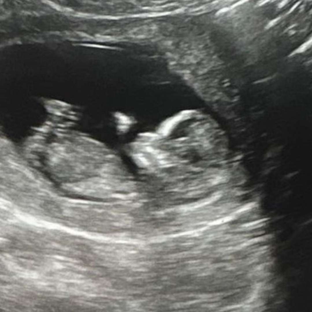 Photo shared by Saribel for their Babylist baby registry.