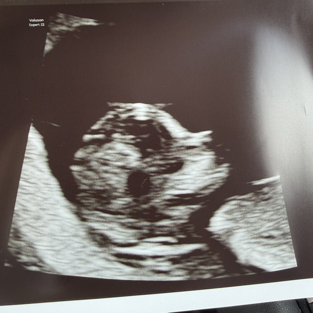 Photo shared by Kimberly for their Babylist baby registry.