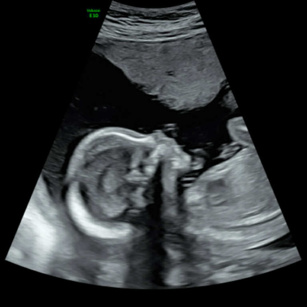 Photo shared by Becky for their Babylist baby registry.