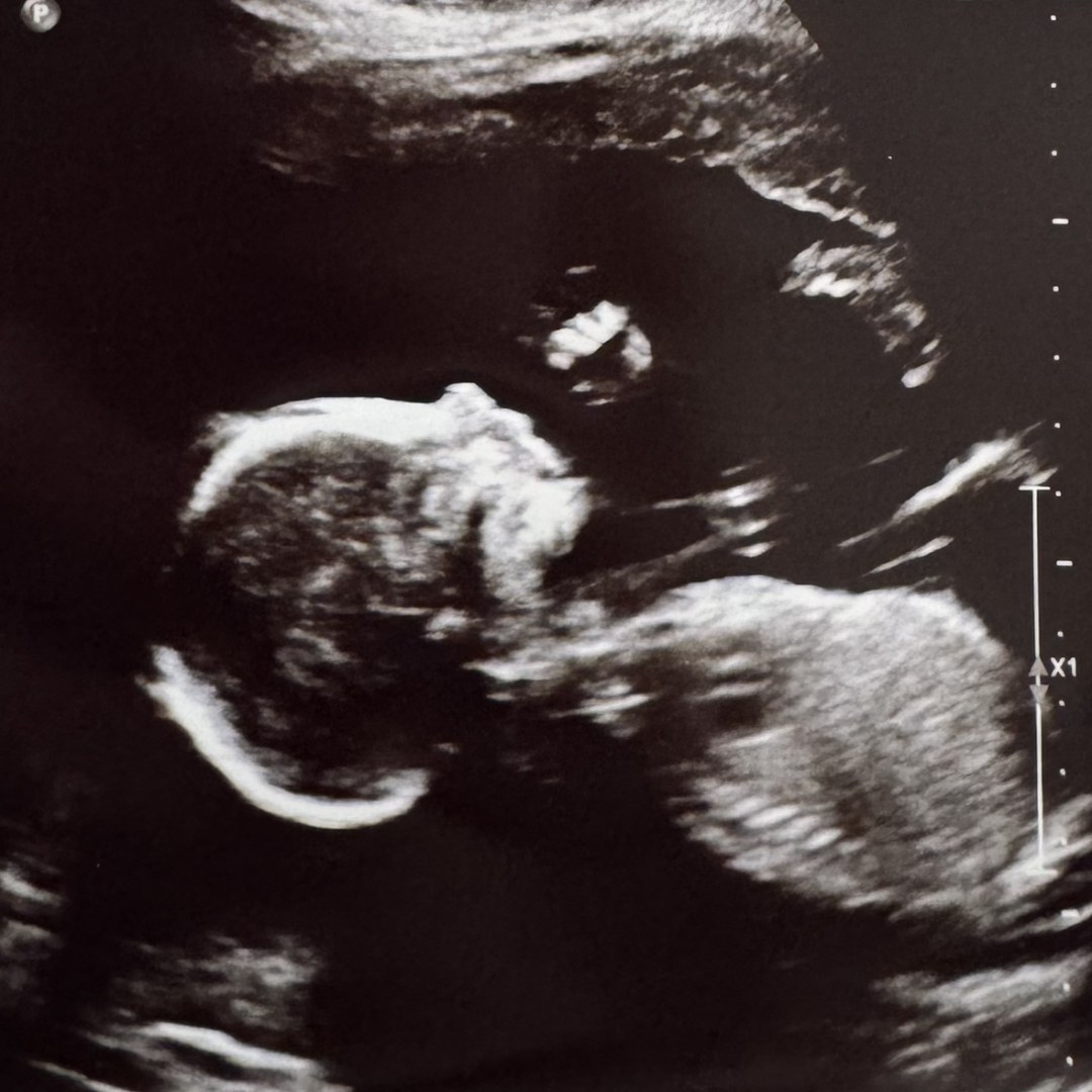 Photo shared by Hollis for their Babylist baby registry.