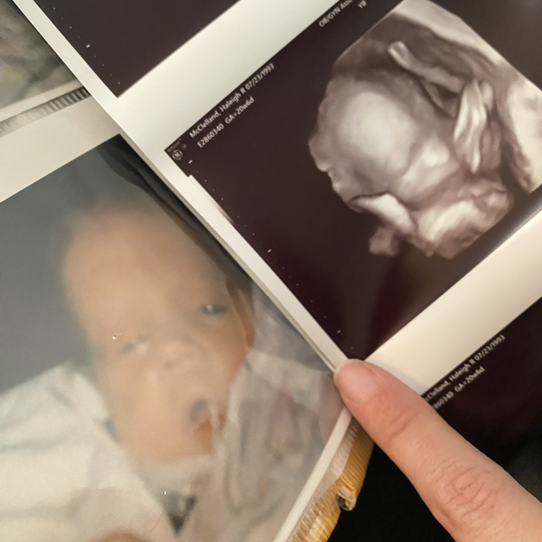 Photo shared by Haleigh for their Babylist baby registry.