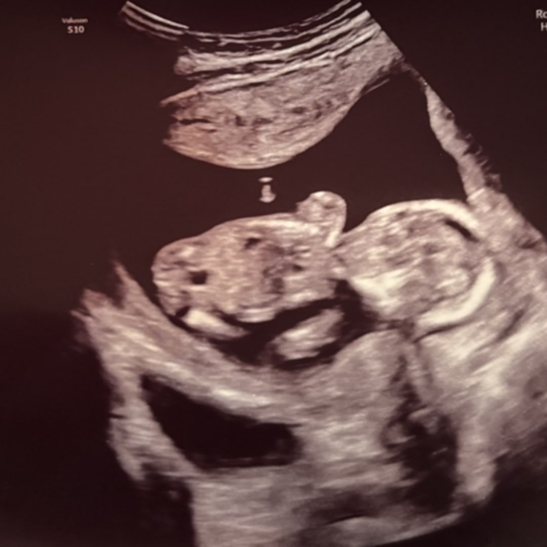 Photo shared by Andrea for their Babylist baby registry.