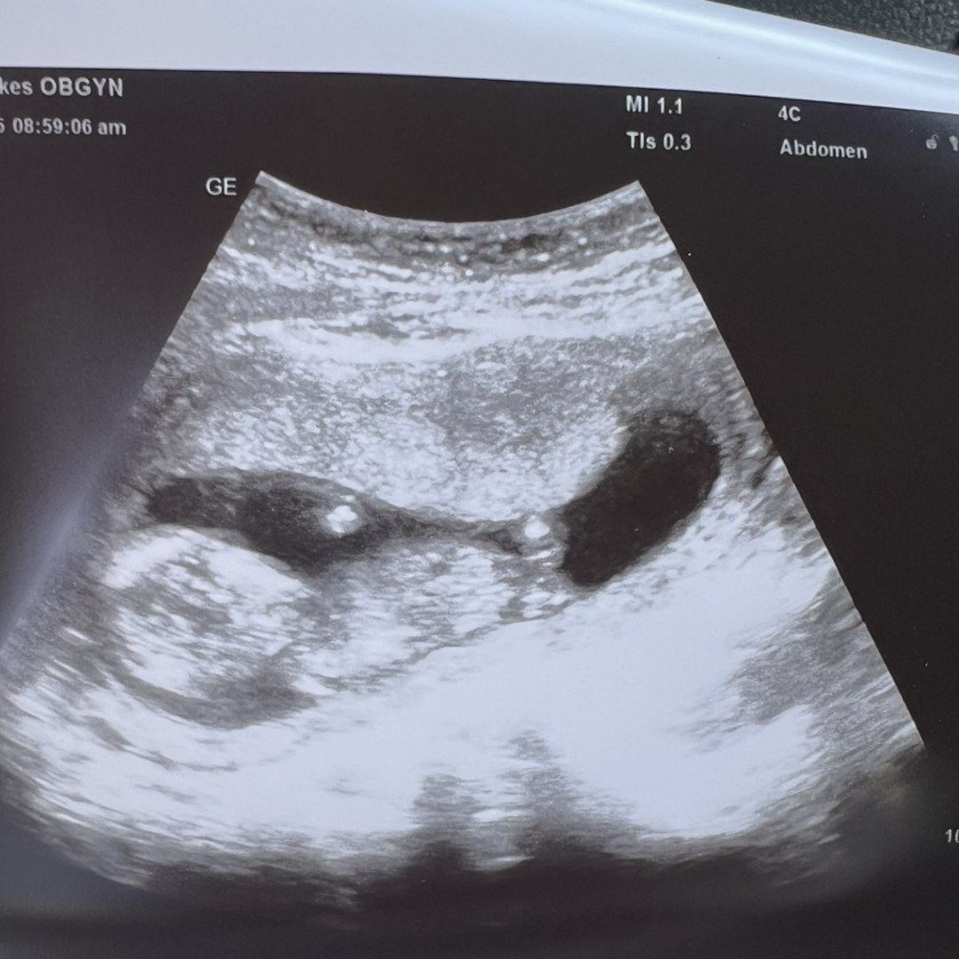 Photo shared by Tonia for their Babylist baby registry.