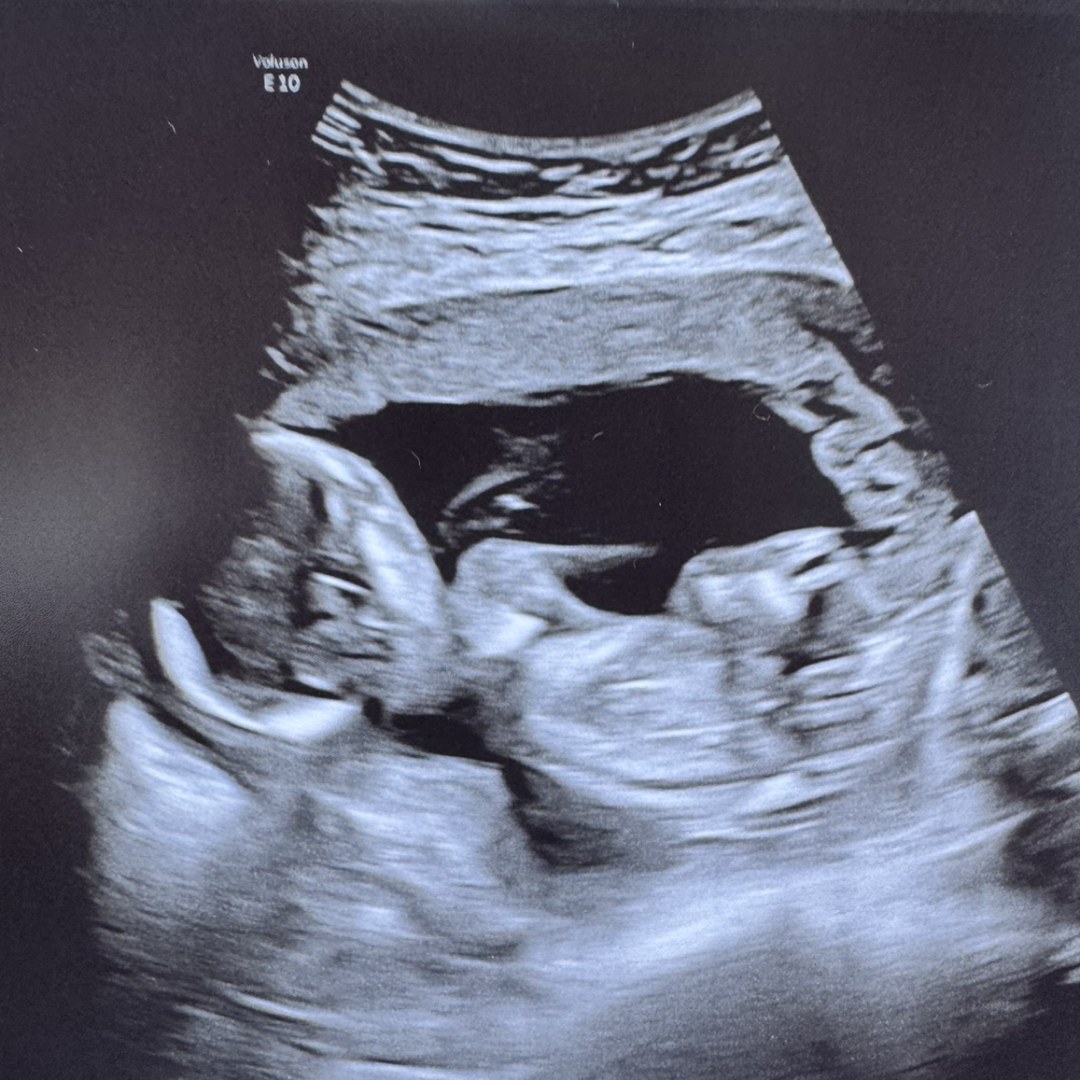 Photo shared by Forest for their Babylist baby registry.