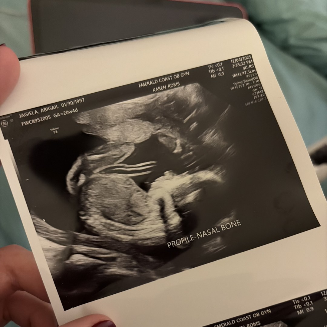 Photo shared by Abby for their Babylist baby registry.