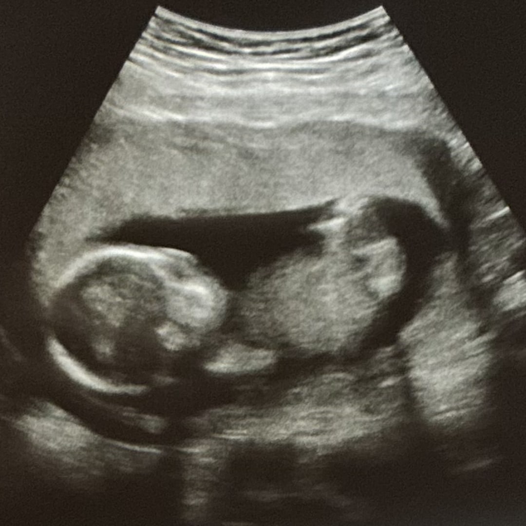 Photo shared by Cristina for their Babylist baby registry.