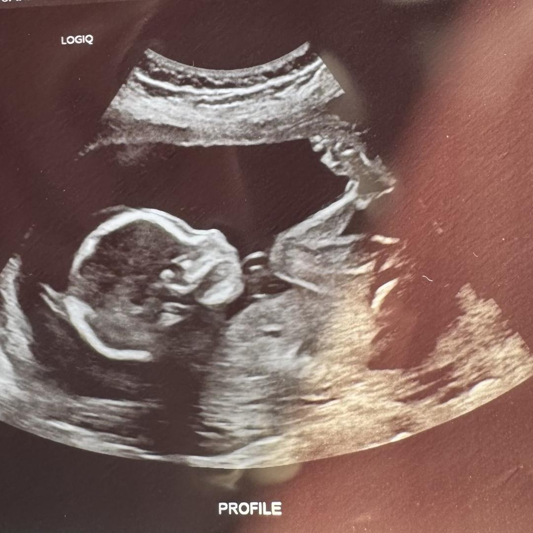 Photo shared by Baylee for their Babylist baby registry.