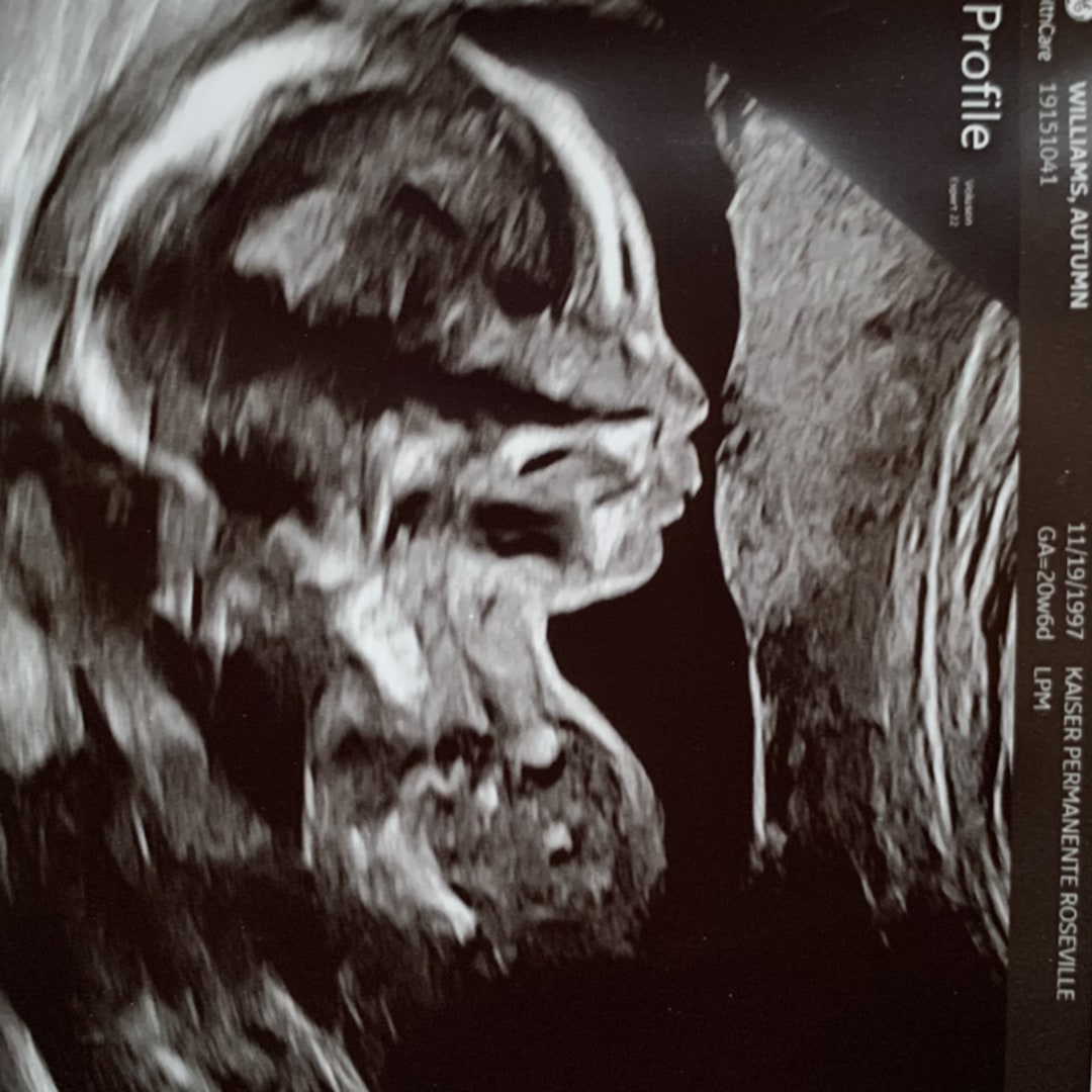 Photo shared by Autumn for their Babylist baby registry.